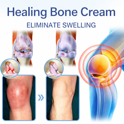 ✅FDA Certified :  Cheemex® Magnesium Pain Healing Bone Cream ( Treatment for arthritis, neuropathyy, rheumatic diseases, sports injuries, twitches and muscle spasms)
