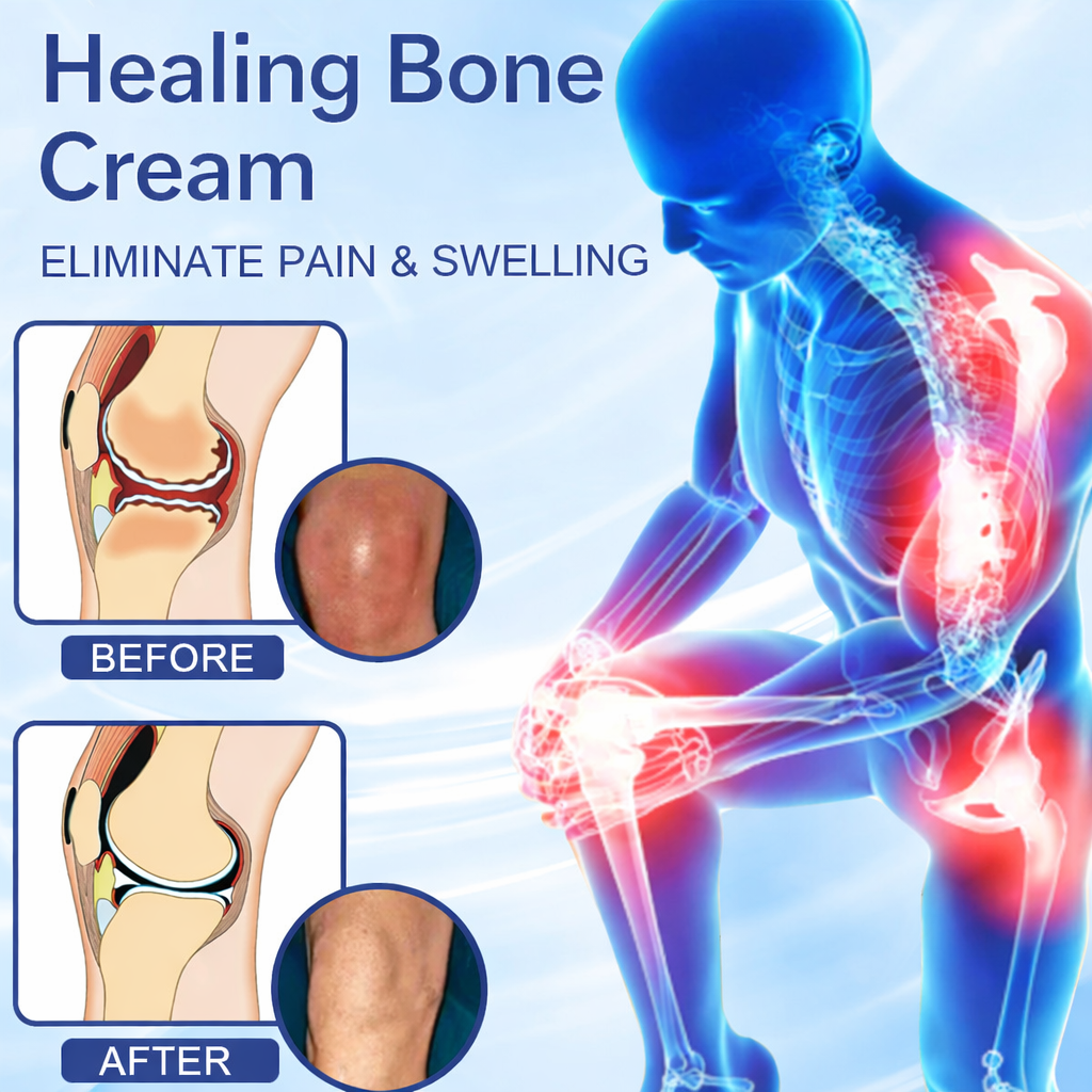 ✅FDA Certified :  Cheemex® Magnesium Pain Healing Bone Cream ( Treatment for arthritis, neuropathyy, rheumatic diseases, sports injuries, twitches and muscle spasms)