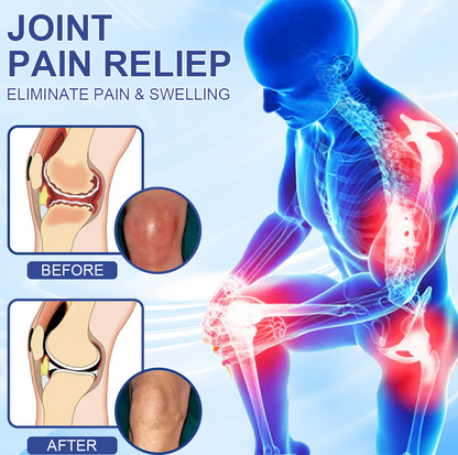 ✅FDA Certified :  Cheemex® Magnesium Pain Healing Bone Cream ( Treatment for arthritis, neuropathyy, rheumatic diseases, sports injuries, twitches and muscle spasms)