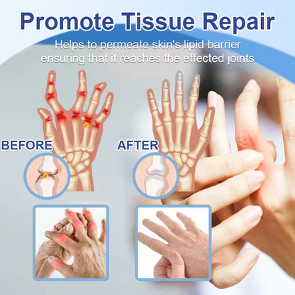 ✅FDA Certified :  Cheemex® Magnesium Pain Healing Bone Cream ( Treatment for arthritis, neuropathyy, rheumatic diseases, sports injuries, twitches and muscle spasms)