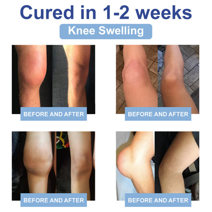 ✅FDA Certified :  Cheemex® Magnesium Pain Healing Bone Cream ( Treatment for arthritis, neuropathyy, rheumatic diseases, sports injuries, twitches and muscle spasms)