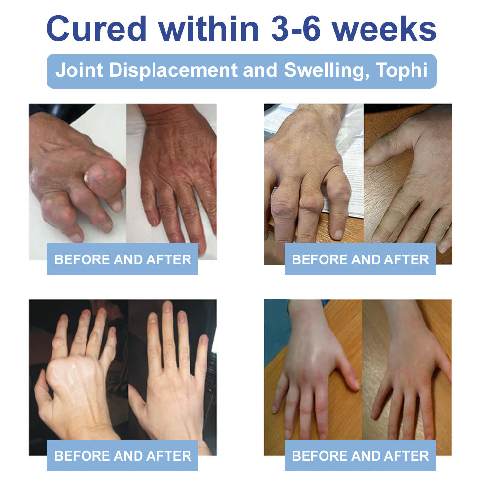 ✅FDA Certified :  Cheemex® Magnesium Pain Healing Bone Cream ( Treatment for arthritis, neuropathyy, rheumatic diseases, sports injuries, twitches and muscle spasms)