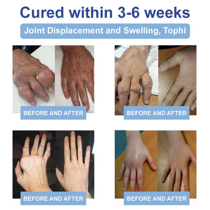 ✅FDA Certified :  Cheemex® Magnesium Pain Healing Bone Cream ( Treatment for arthritis, neuropathyy, rheumatic diseases, sports injuries, twitches and muscle spasms)